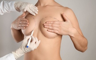 методи за уголемяване на гърдите с операция